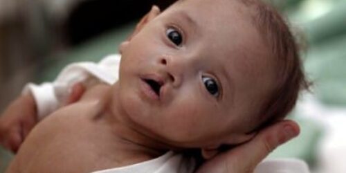 Aborto e eugenia sem censura