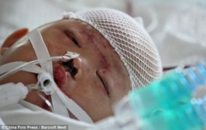 Menina chinesa no hospital. Não resistiu