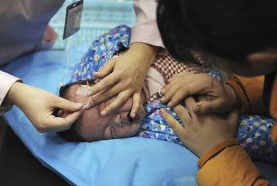 Criança com problemas respiratório em Hefei, província de Anhui