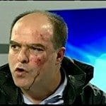 Venezuela: Violência contra deputados da oposição