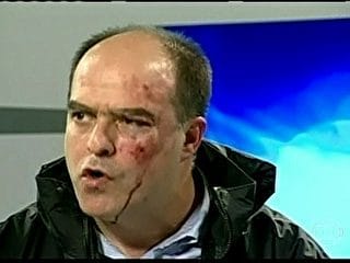 No momento, você está visualizando Venezuela: Violência contra deputados da oposição