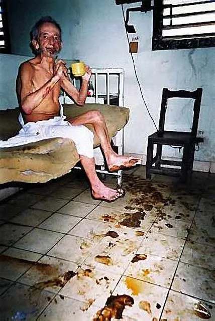Hospital em Cuba. Fotos divulgadas por emigrados cubanos ilustram este post. O respeito pela dignidade humana nos levou a não publicá-las. Porém, os riscos que corre o Brasil agora nos levam a fazê-lo.