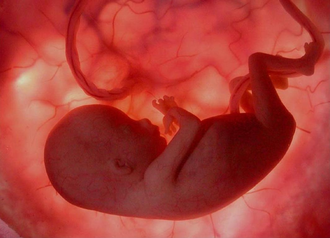 No momento, você está visualizando Governo oficializa aborto e paga R$ 443 pelo SUS