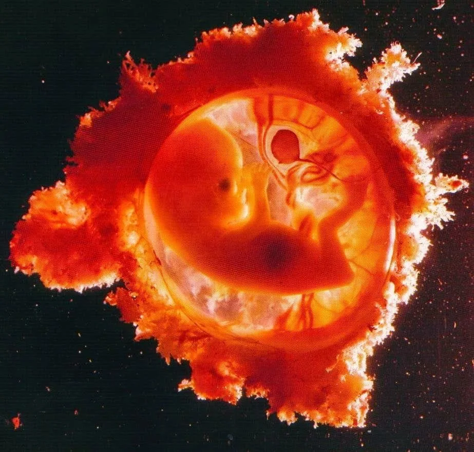 No momento, você está visualizando “Nós, pró-abortistas…”  – finalmente um defensor do aborto atribui a si esse adjetivo