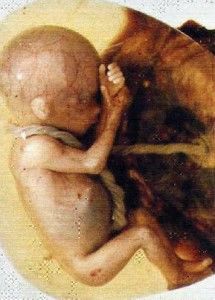 abortoeeuu-215x300