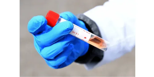 Coronavírus: EUA constata kits de testes chineses contaminados. Uma previsão confirmada