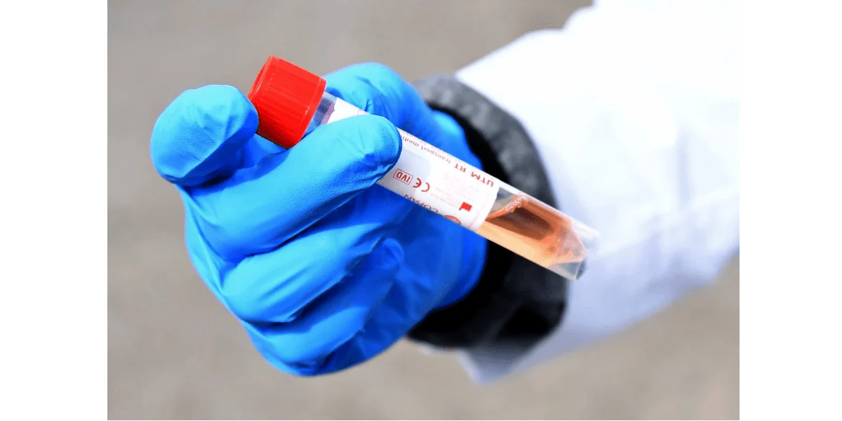 No momento, você está visualizando Coronavírus: EUA constata kits de testes chineses contaminados. Uma previsão confirmada